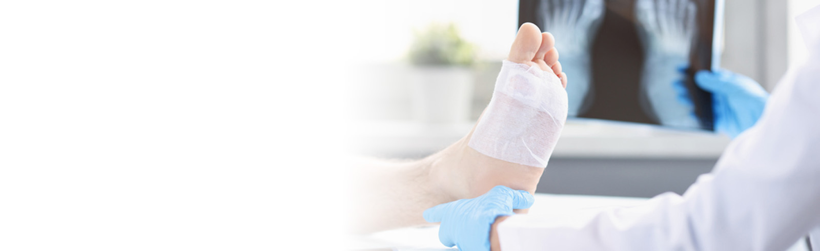 doctor tending to a patients wrapped foot while holding an x-ray of the feet.